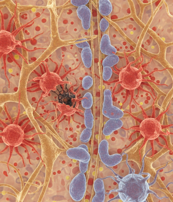 Neuroinflammation