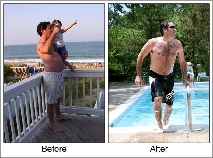 Before & After